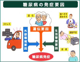 糖尿病の発症要因