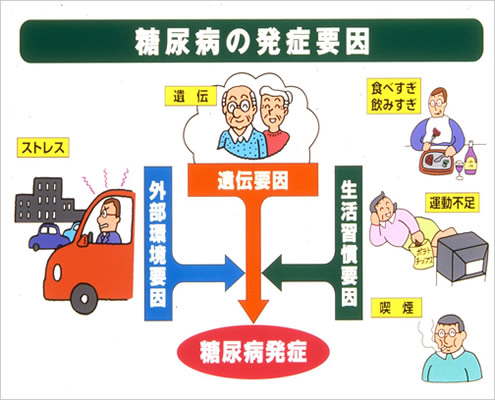 糖尿病の発症要因